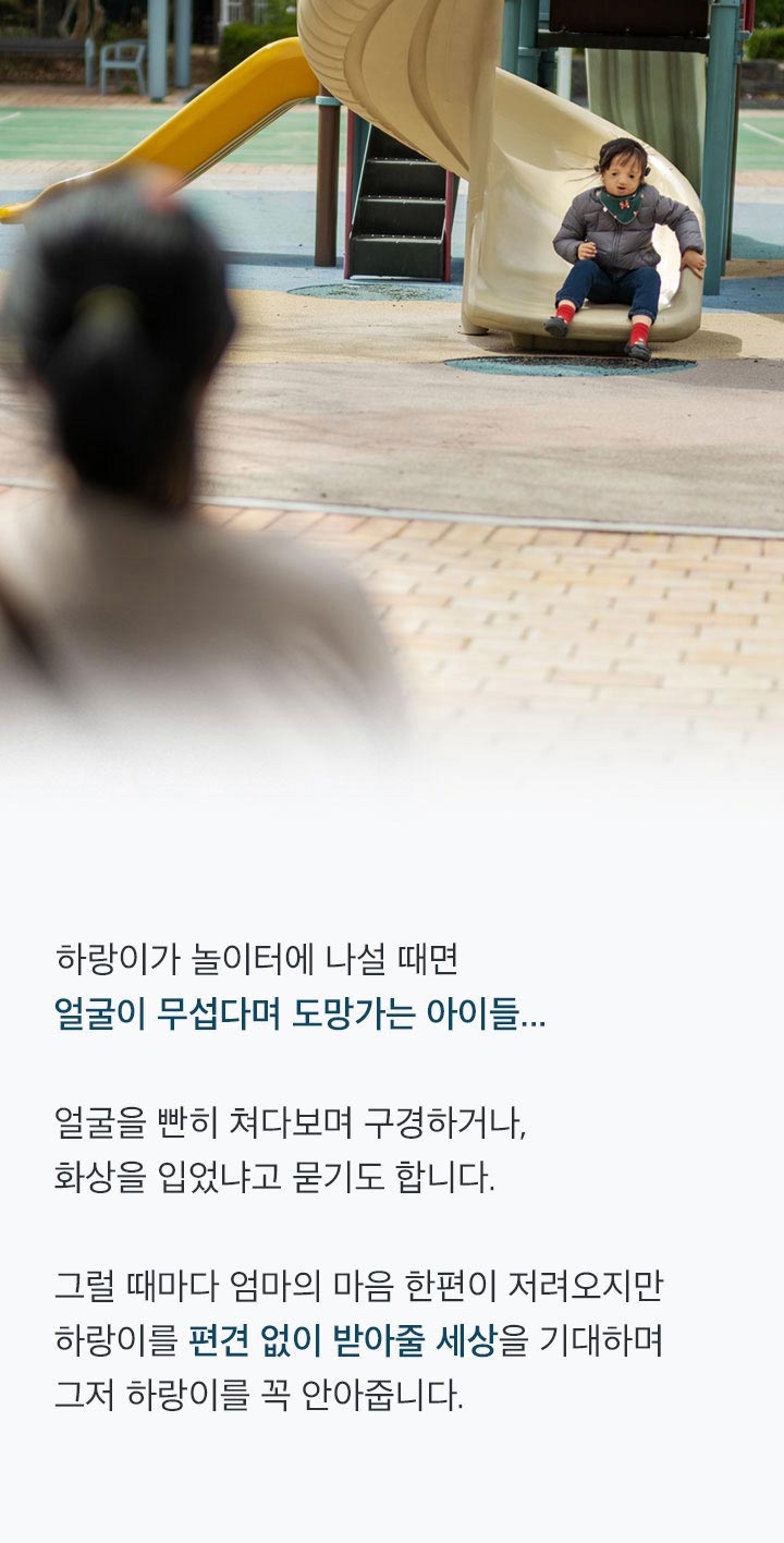 ＂엄마! 쟤 얼굴 이상해＂