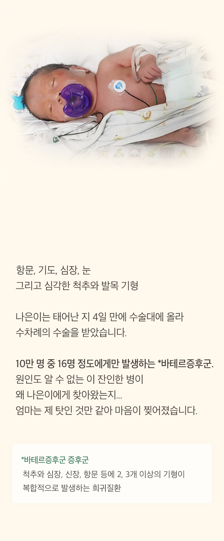복잡한 기형을 가지고 태어난 나은이