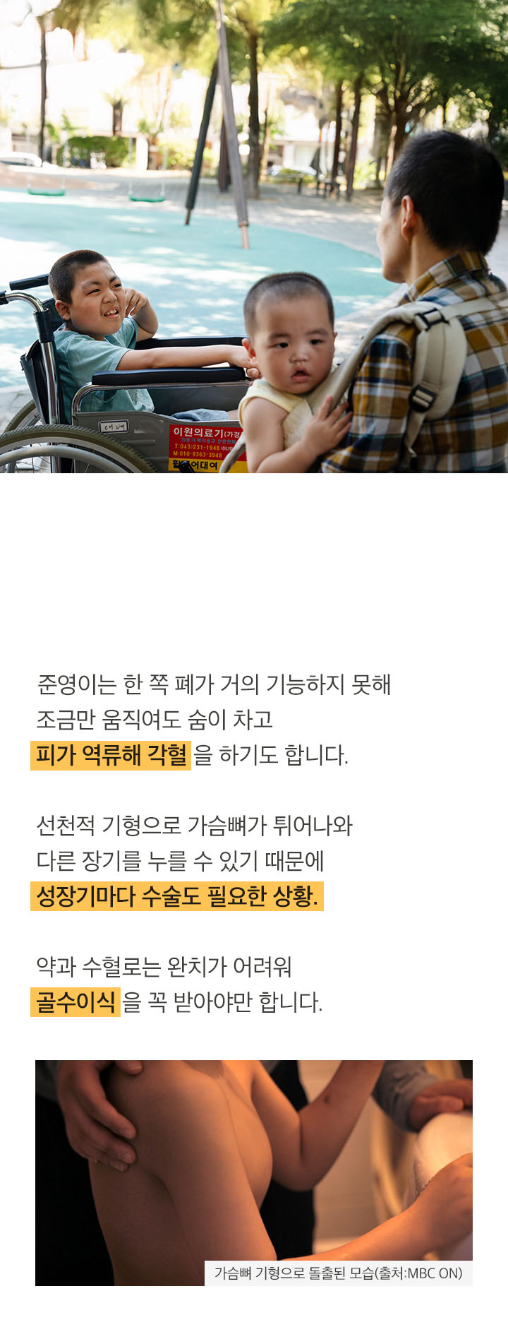 스테로이드 약, 골수 이식… 벅찬 치료들